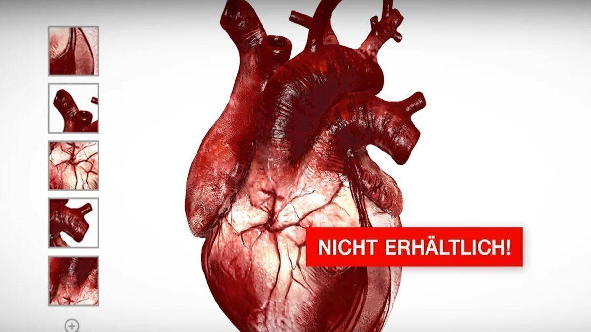 Unbezahlbar und nur schwer erhältlich: menschliche Organe.